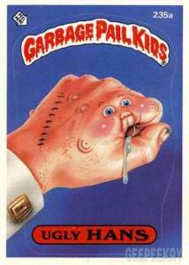 1985 Garbage Pail Kids Card #235a Ugly Hans
